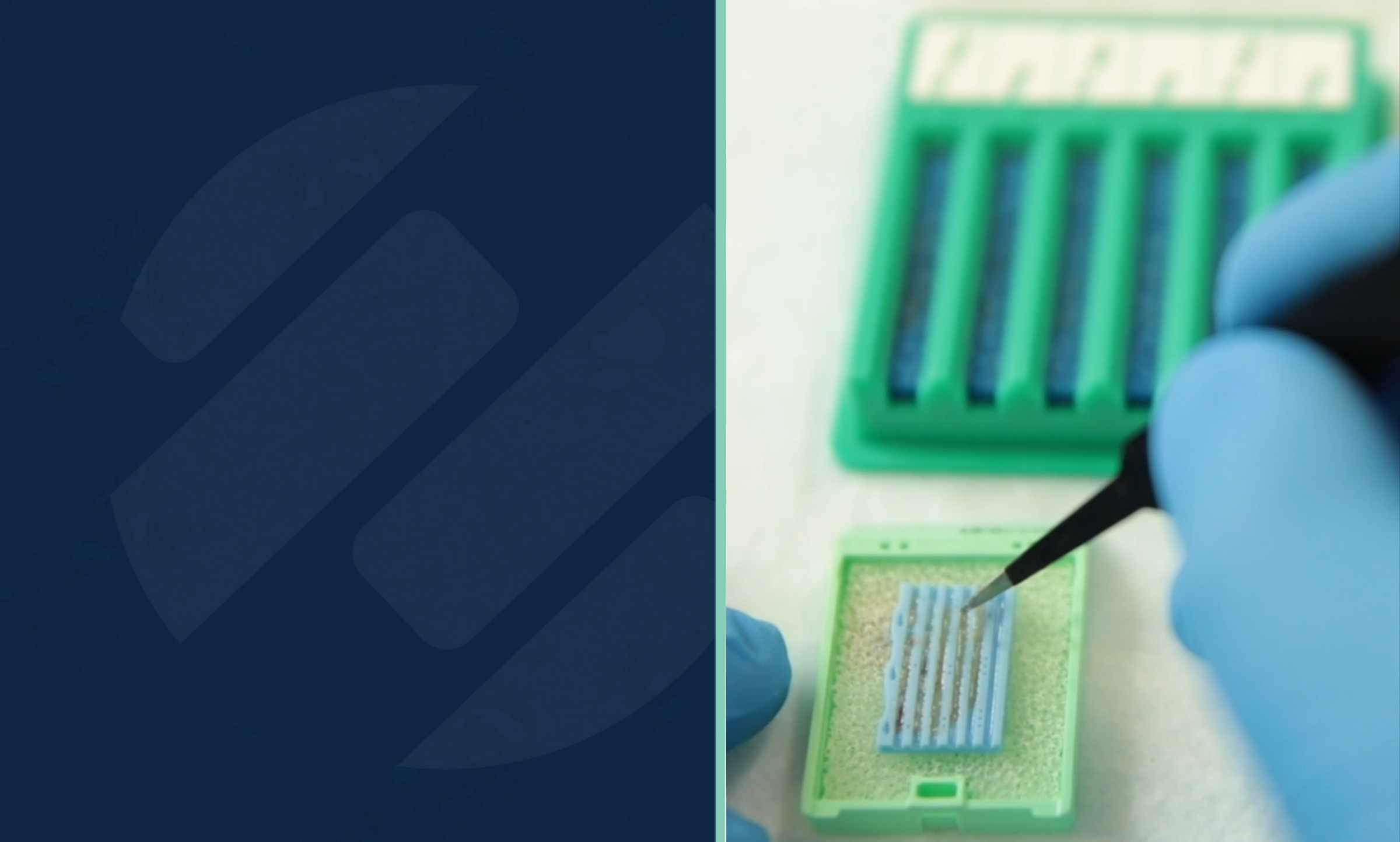 Lumea Technology Improves Histotechnologist’s Practice