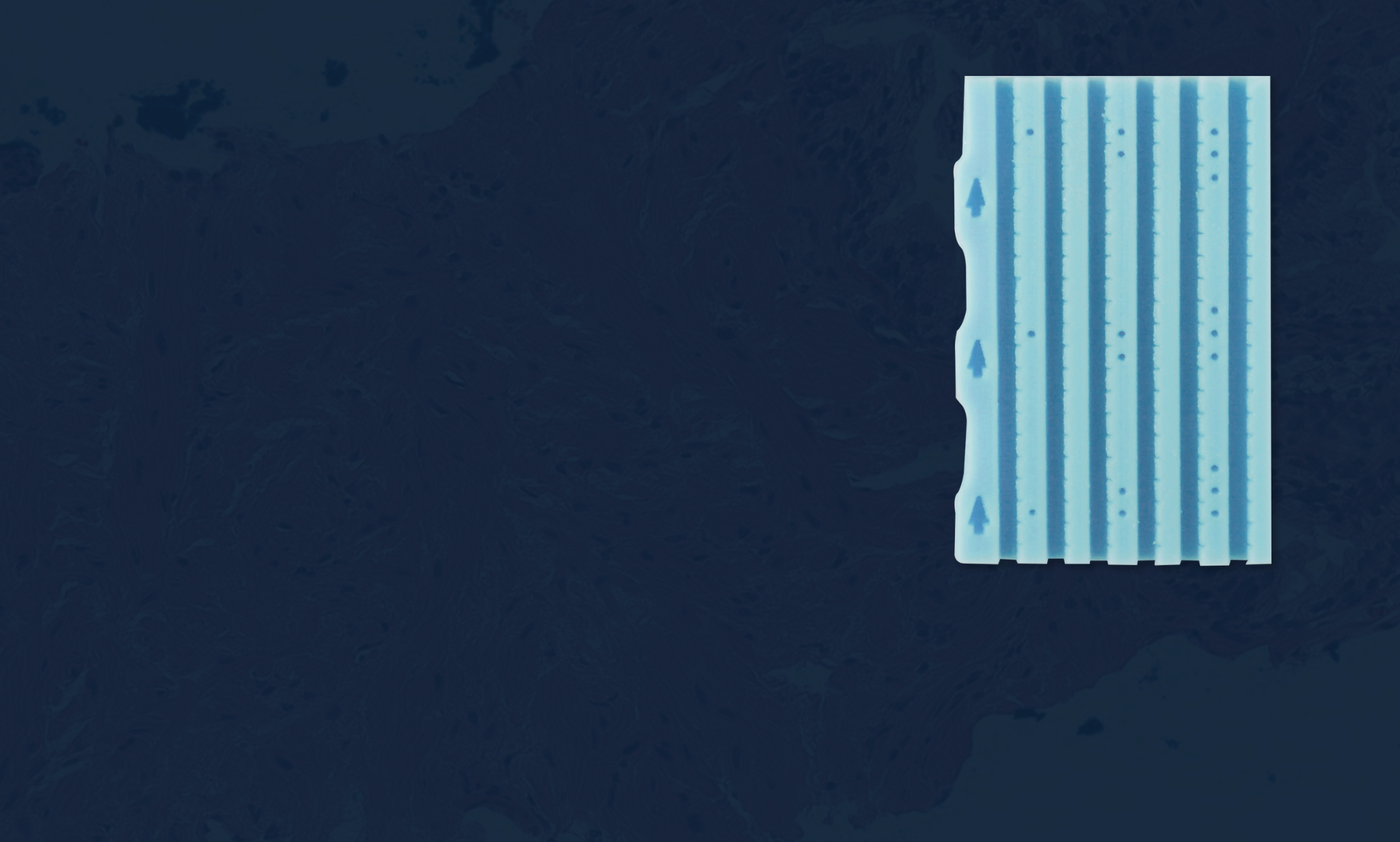 MP16-19 BxChip™ Clinical Tissue Array Increases Cancer Detection Rate & Amount Of Tissue Available For Pathologist Review