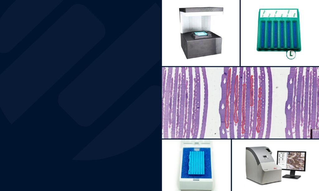 digital pathology technology for prostate cancer