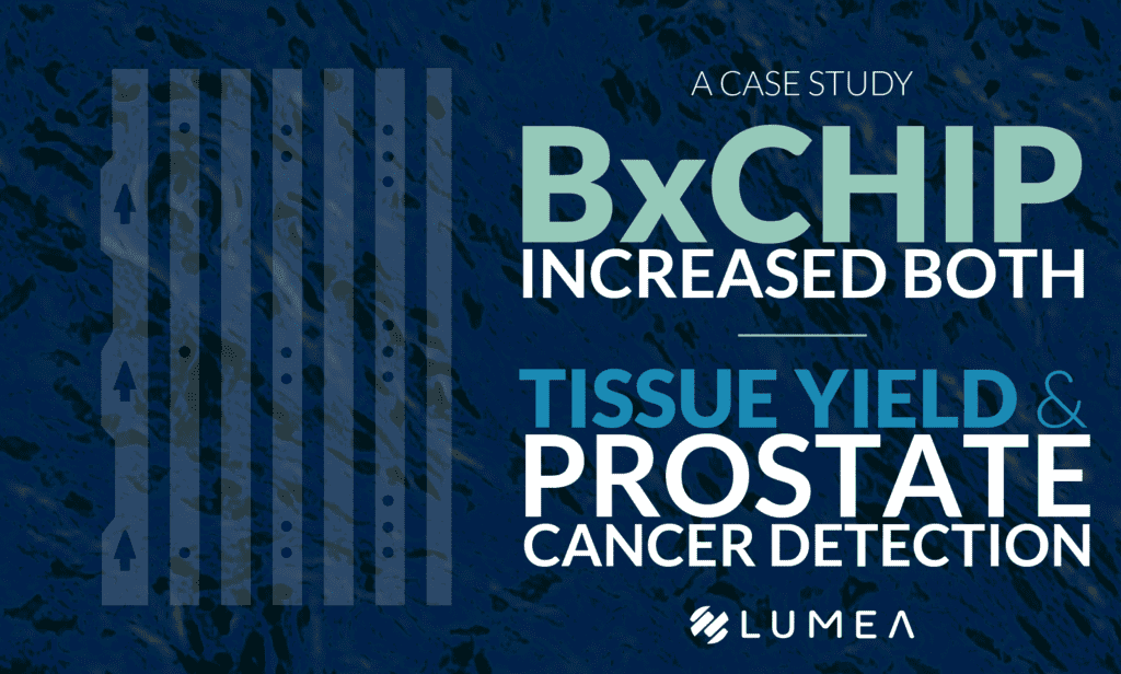 a graphic of the BxChip which increases prostate cancer detection and tissue yield