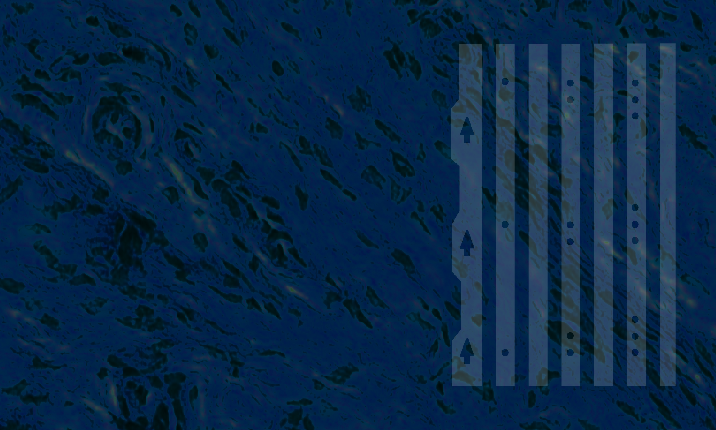 Lumea BxChip® Increased Both Tissue Yield and Prostate Cancer Detection