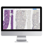 DxAlign Lumea Digital Pathology Tech