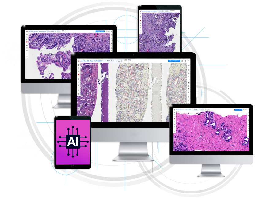 Viewer plus graphics