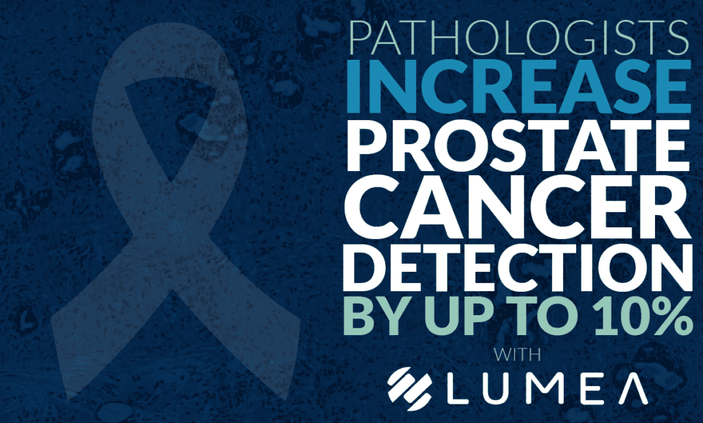 pathologists increase prostate cancer detection by up to 10% with Lumea, next to a prostate cancer awareness ribbon