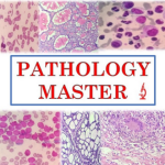 Pathology Master YouTube thumbnail | Lumea Pathology Master YouTube thumbnail