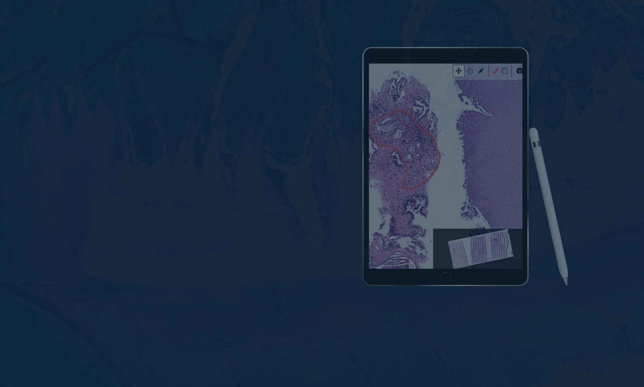 Can Digital Pathology Really Be More Efficient than Traditional Pathology?