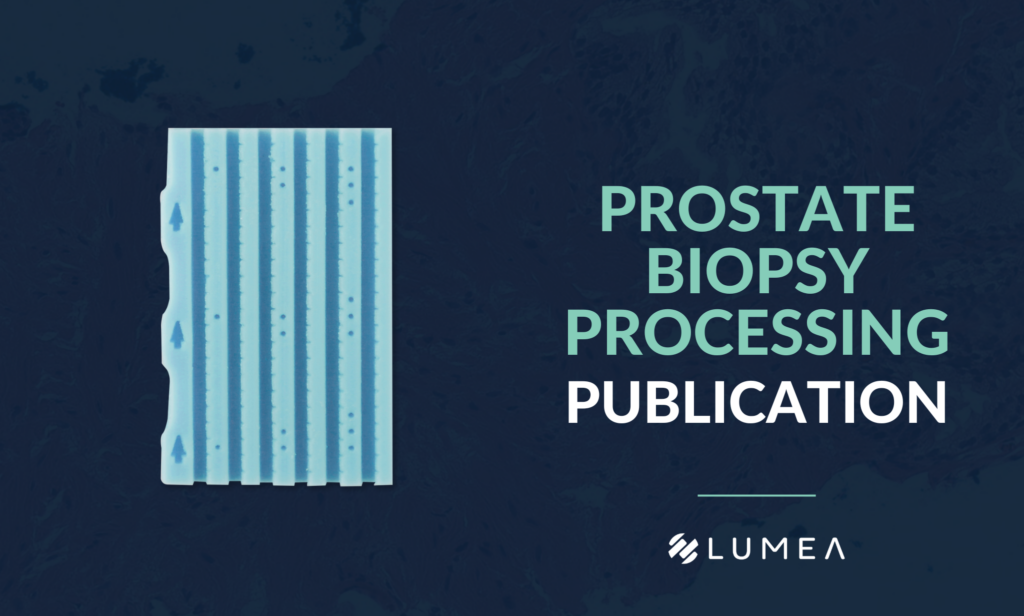 Prostate Biopsy Processing: An Innovative Model for Reducing Cost, Decreasing Test Time, and Improving Diagnostic Material