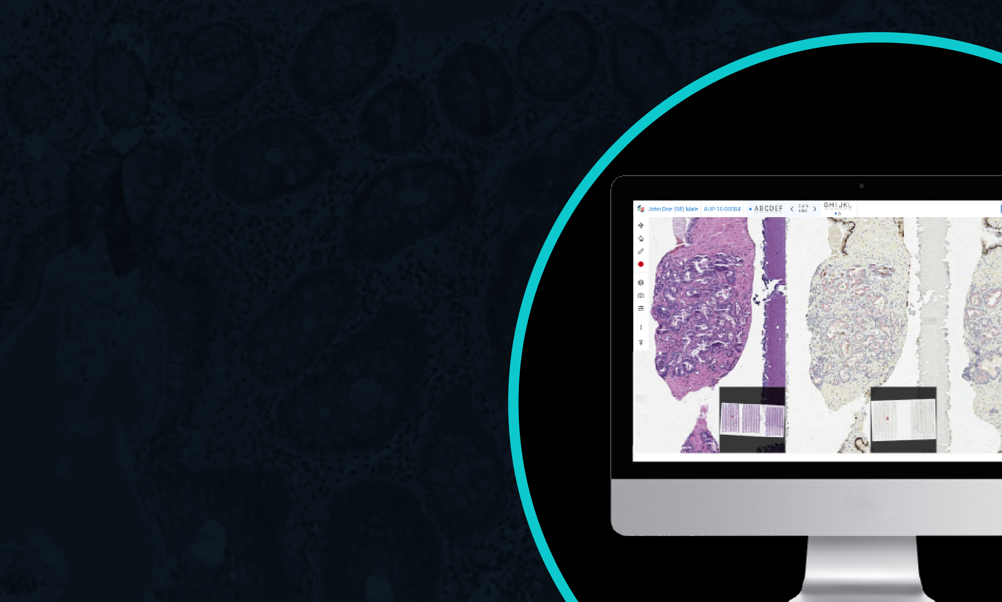 Top 10 Things to Consider When Choosing a Computer for Digital Pathology