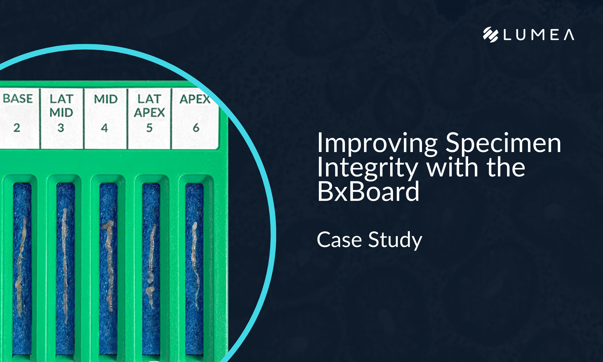 A Case Study: Improving Specimen Integrity with the BxBoard