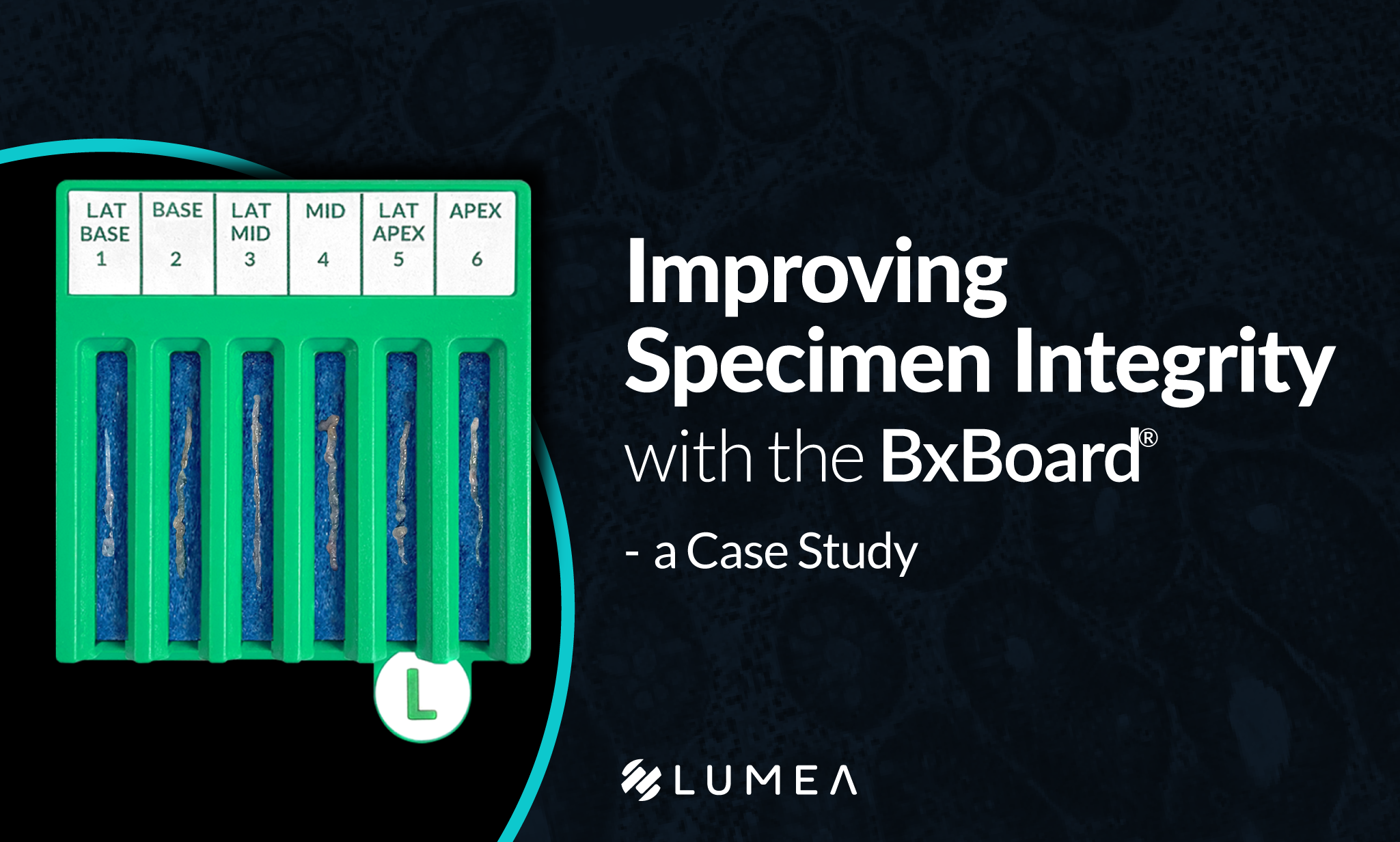 A Case Study: Improving Specimen Integrity with the BxBoard