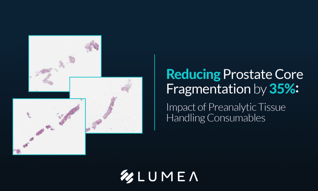How Lumea Technology Delivers a 35% Reduction in Prostate Fragmentation
